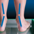 Understanding the Causes of Flat Feet