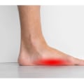 Understanding the Prevalence of Flat Feet