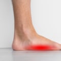 The Impact of Flat Feet on Your Health