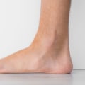 Understanding Flat Feet as a Military Disability