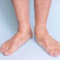 The Truth About Flat Feet: Do They Ever Go Away?