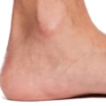 Debunking Myths and Understanding Disability Benefits for Flat Feet