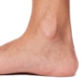 The Truth About Flat Feet: Debunking Myths and Understanding the Risks