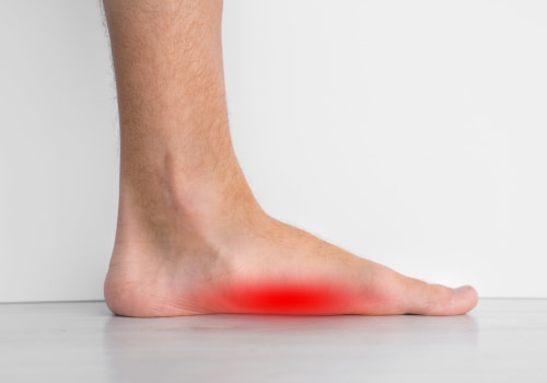 The Impact of Flat Feet on Your Health