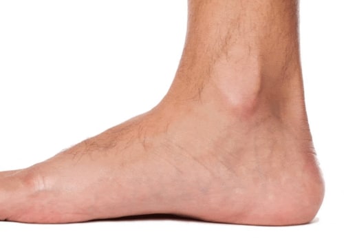 The Truth About Flat Feet: Debunking Myths and Understanding the Risks